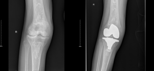 1760096659315003322.png 对比图.png